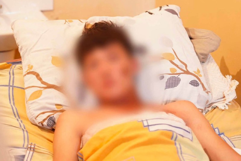 В Джалал-Абадской области подросток выжил после удара молнии