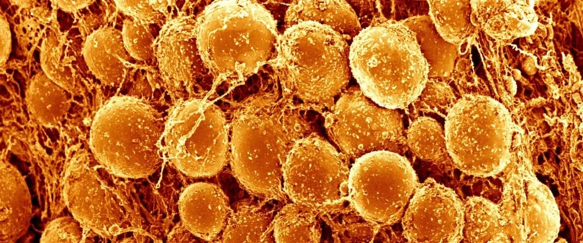 Исследование показало: бурый жир может защищать от депрессии и снижать риски хронических заболеваний